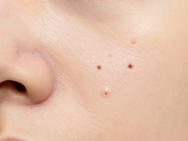 Jak na otevřené pory: Nejlepší tipy a produkty pro zmenšení pórů